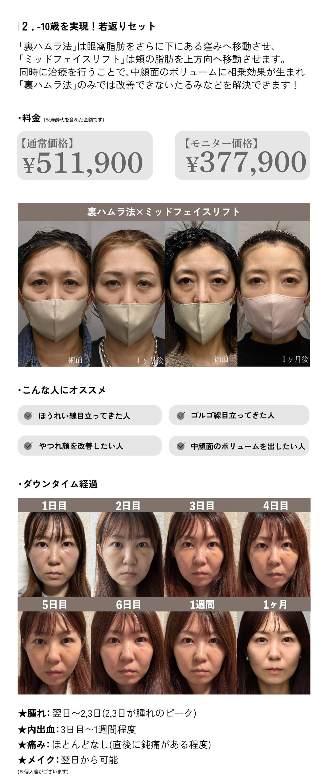 夏のモニター優遇キャンペーン