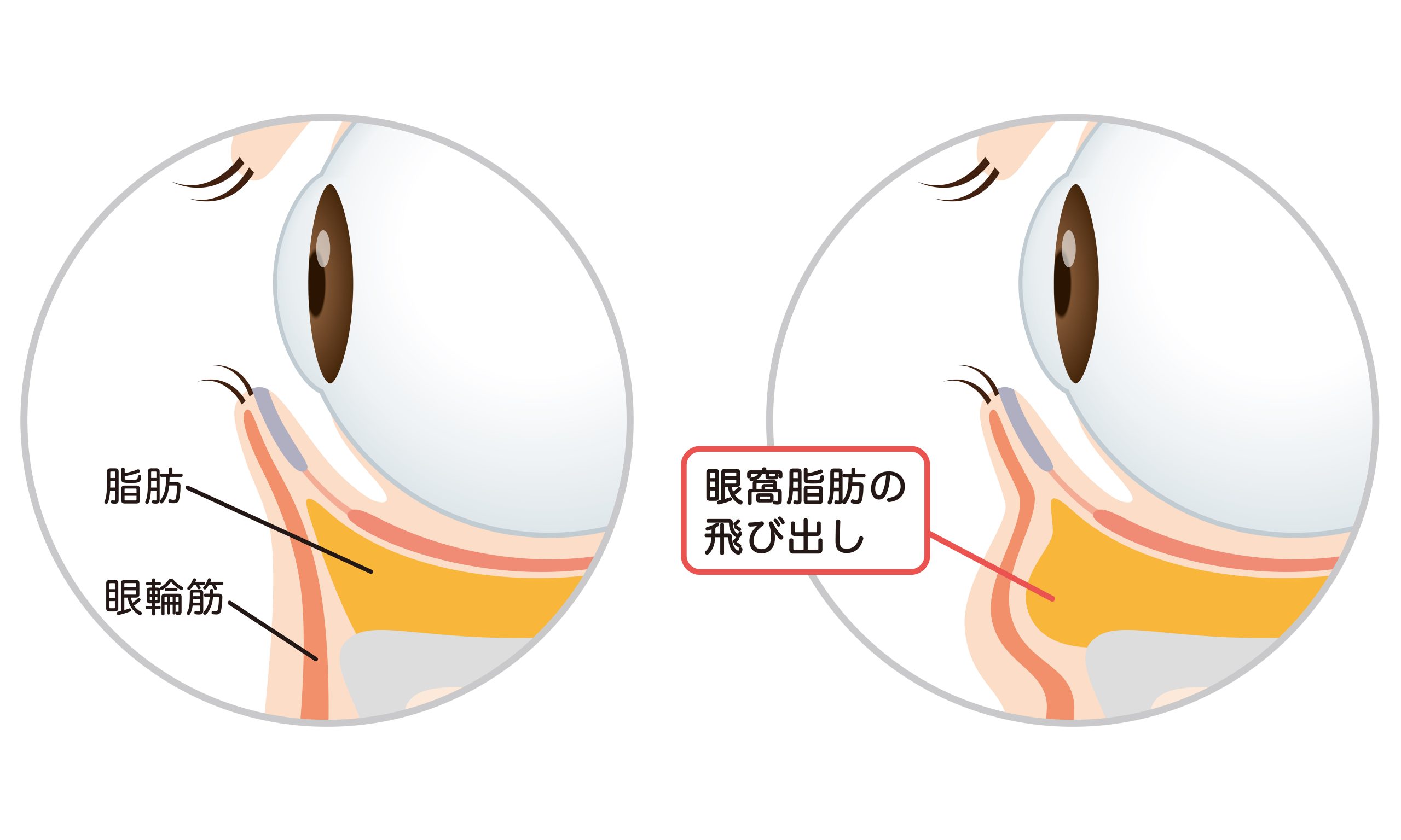 疲れ顔に見せる「クマ」の正体
