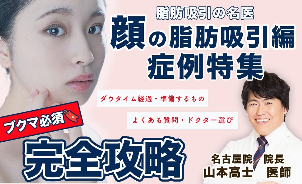 顔の脂肪吸引の名医といえば湘南美容クリニック名古屋栄院の山本高士医師！症例写真を元に解説