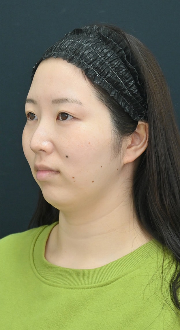 小顔になりたい方