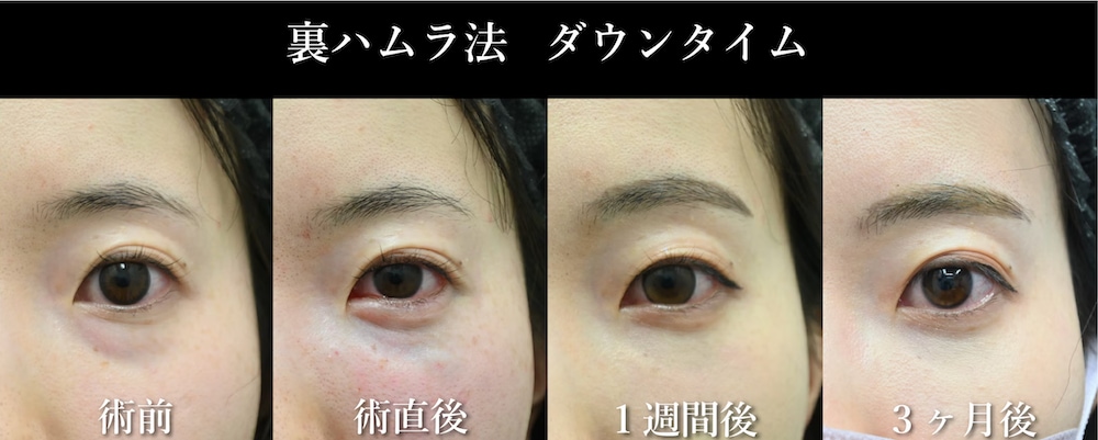 ダウンタイムはどのくらいですか？