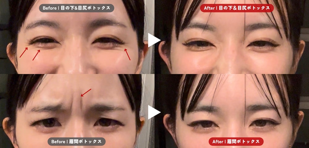 効果が現れるのは？