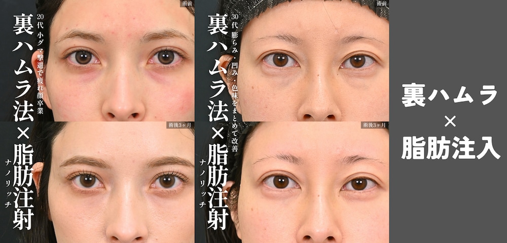 症例写真👇