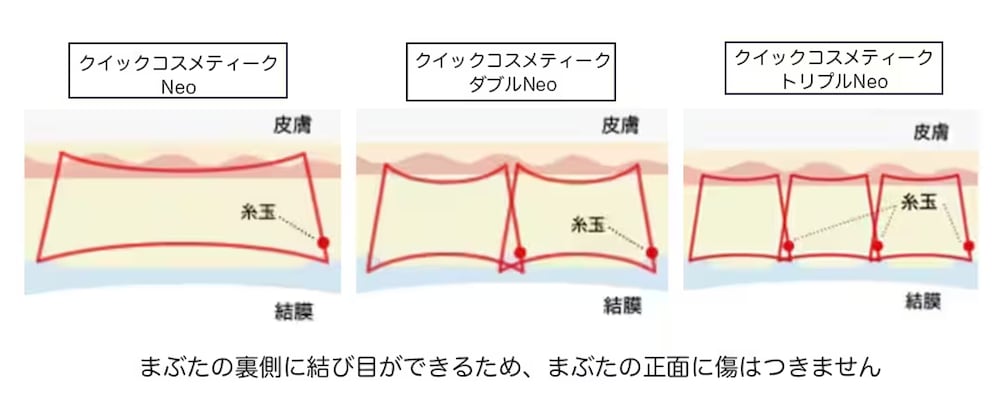 📍クイックコスメティーク法