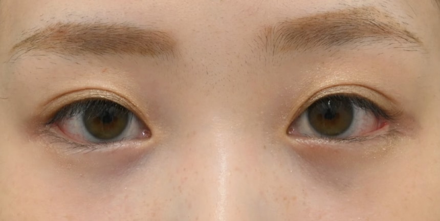 理想のかわいい目元になるフルセット