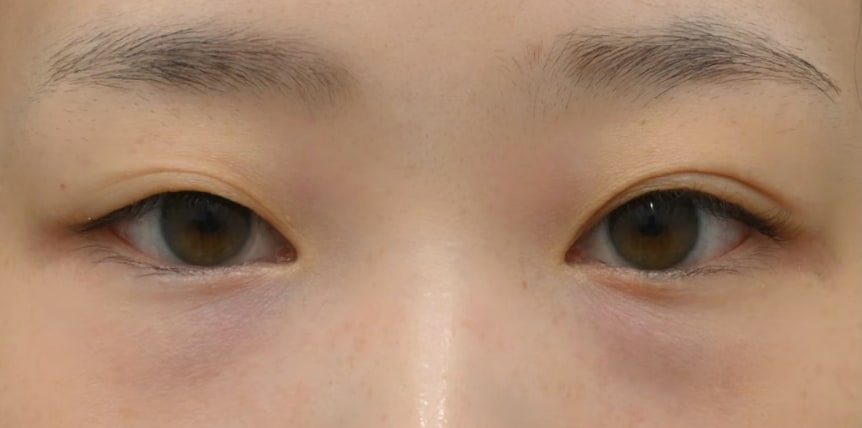 理想のかわいい目元になるフルセット