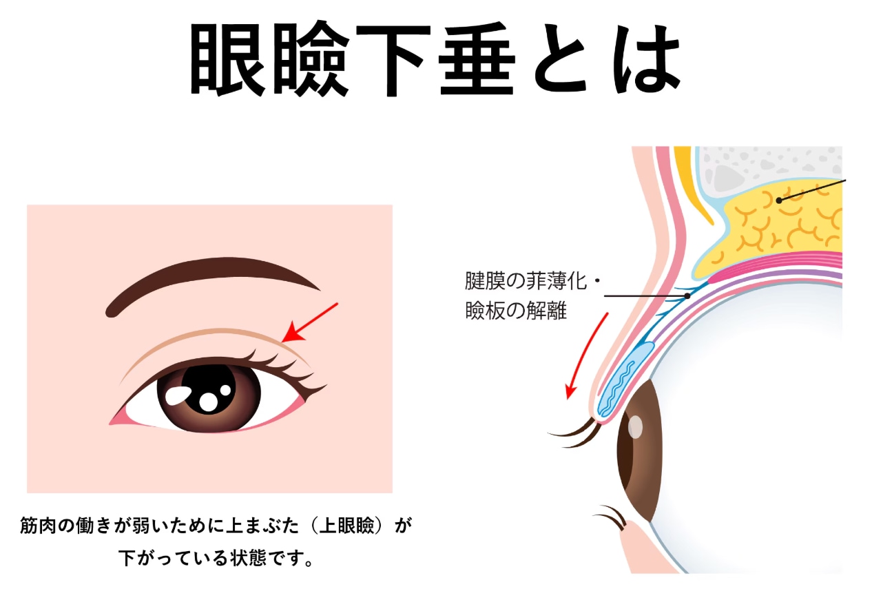 こんな状態👇