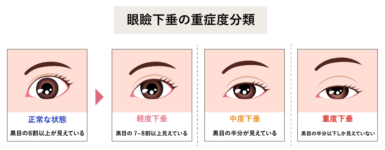 放置すると…🌀