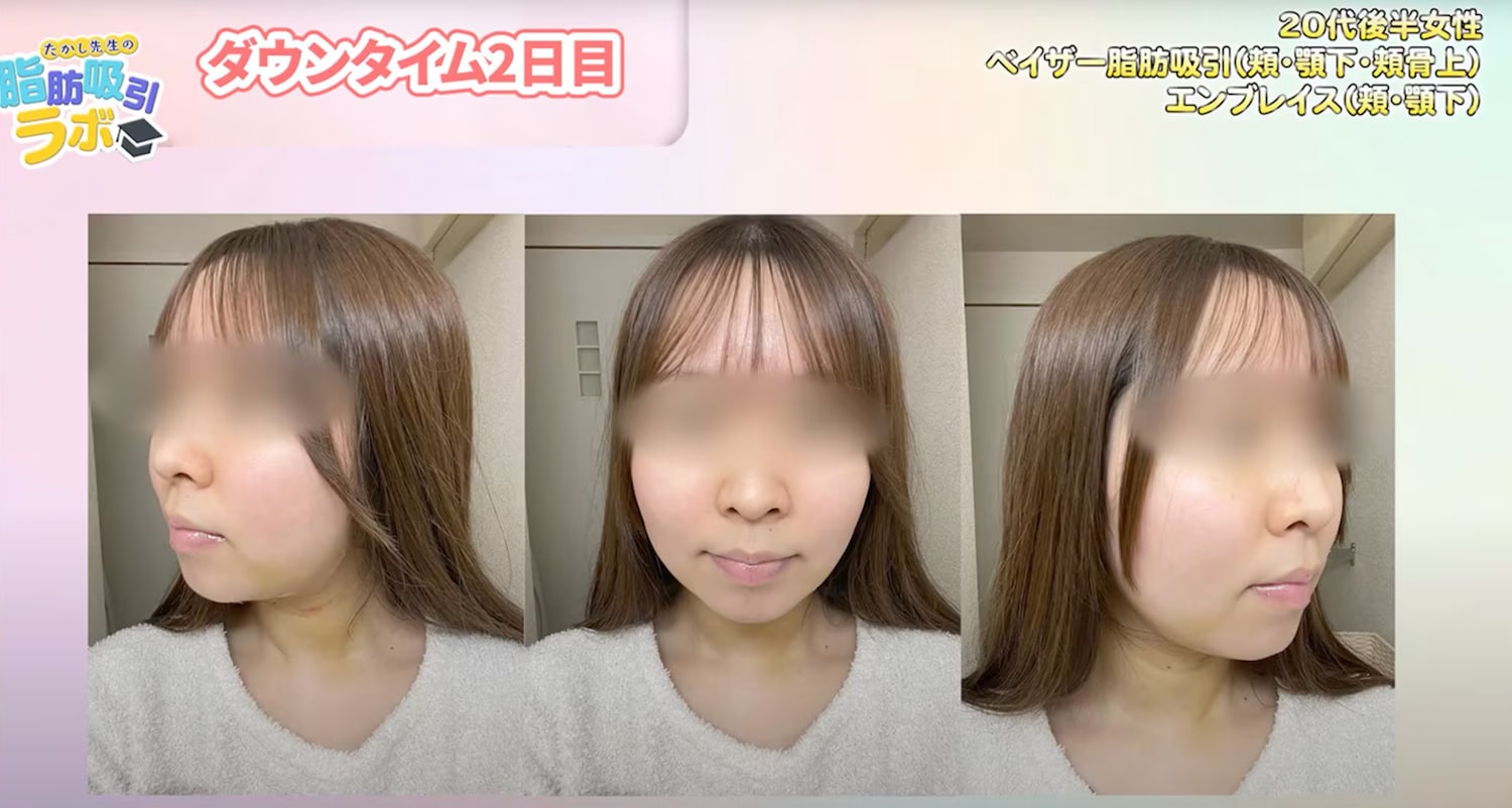 【ダウンタイム2日目】