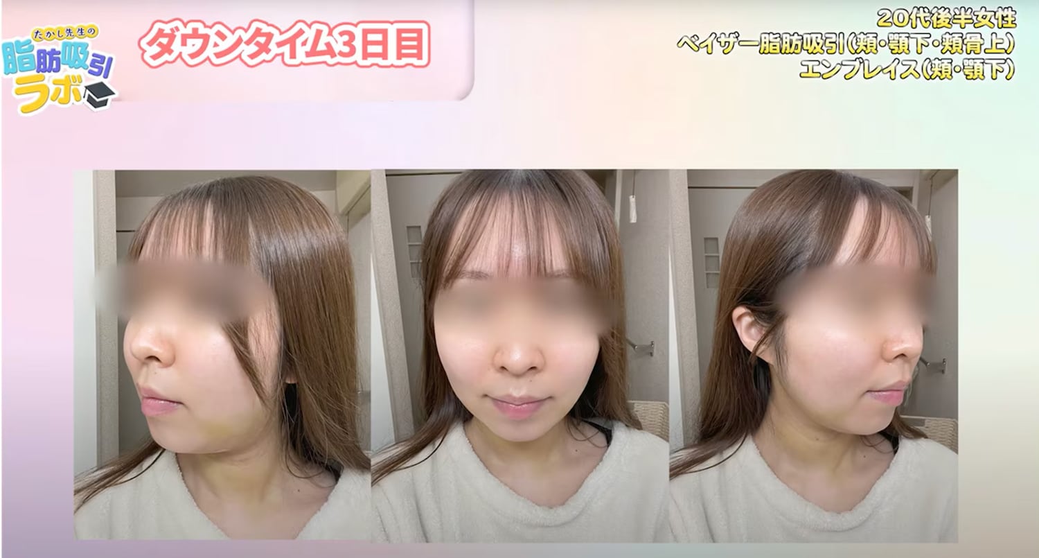 【ダウンタイム３日目】