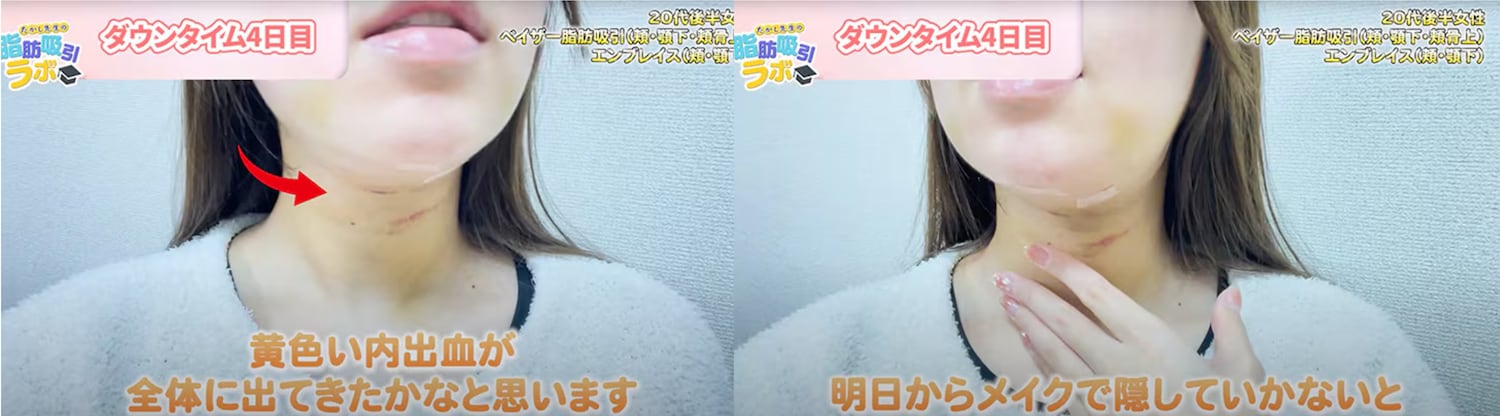 【ダウンタイム4日目】