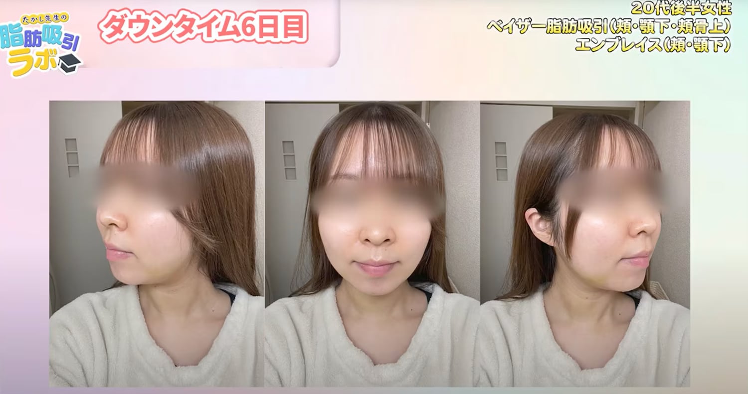 【ダウンタイム６日目】
