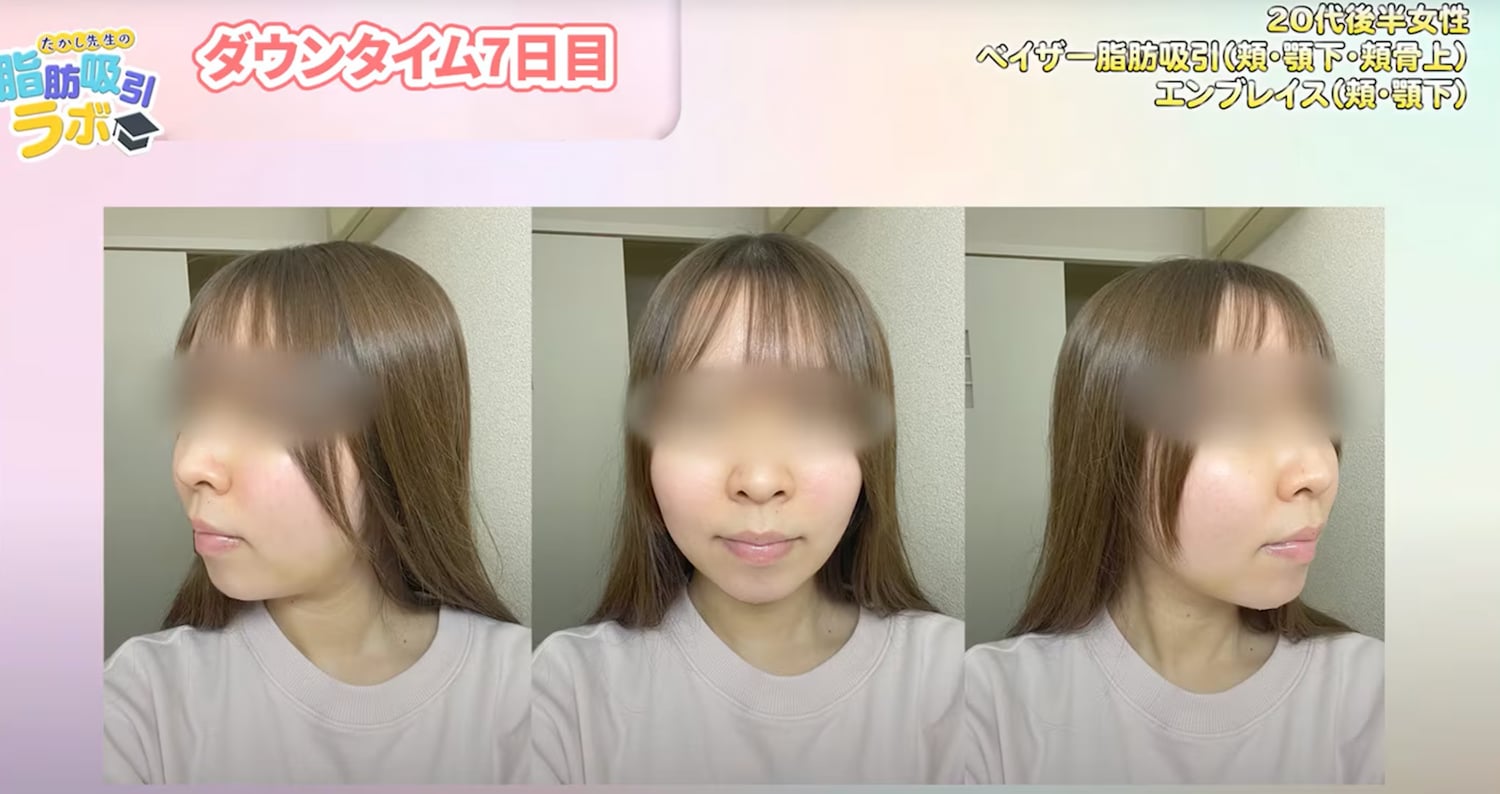 【ダウンタイム７日目】