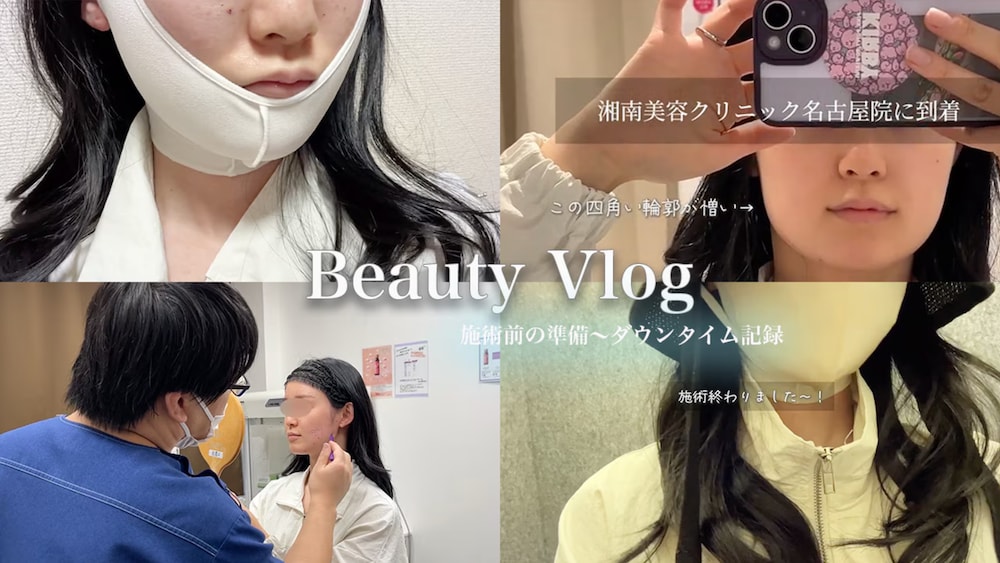 【バッカルファット・糸リフト】四角い顔と野暮ったさ脱却！施術準備からダウンタイムに密着【湘南美容クリニック名古屋栄院】