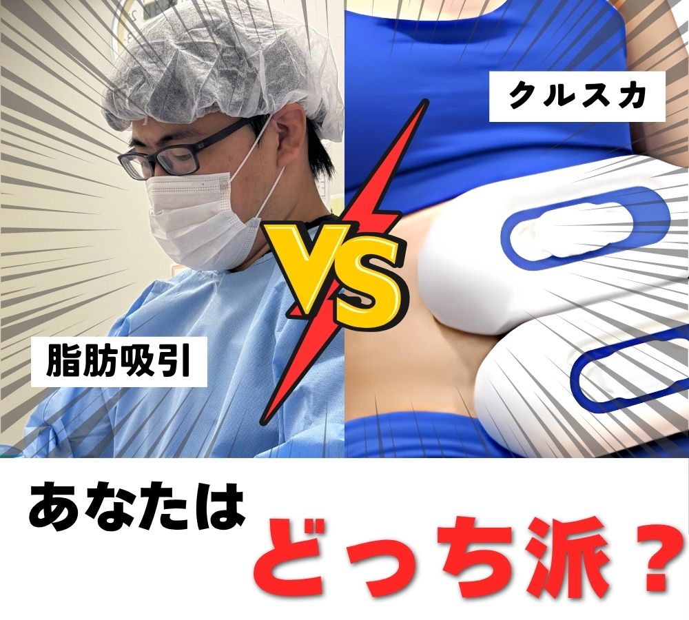 【名古屋栄院】脂肪吸引vsクールスカルプティング徹底解説!あなたはどっち派?!