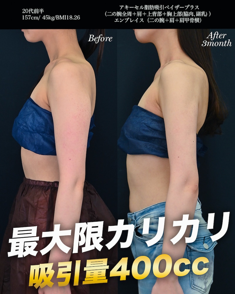 20代モニター　