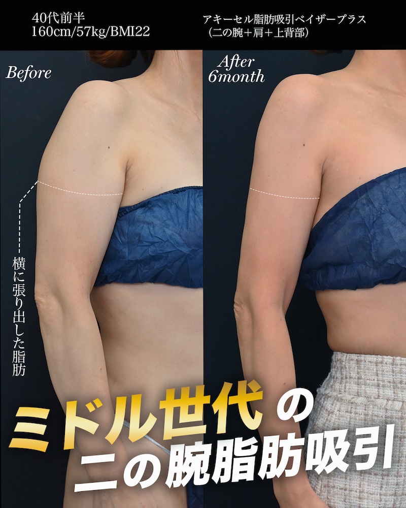 40代のモニター　