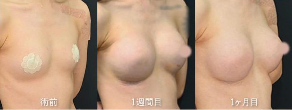 最短ダウンタイム