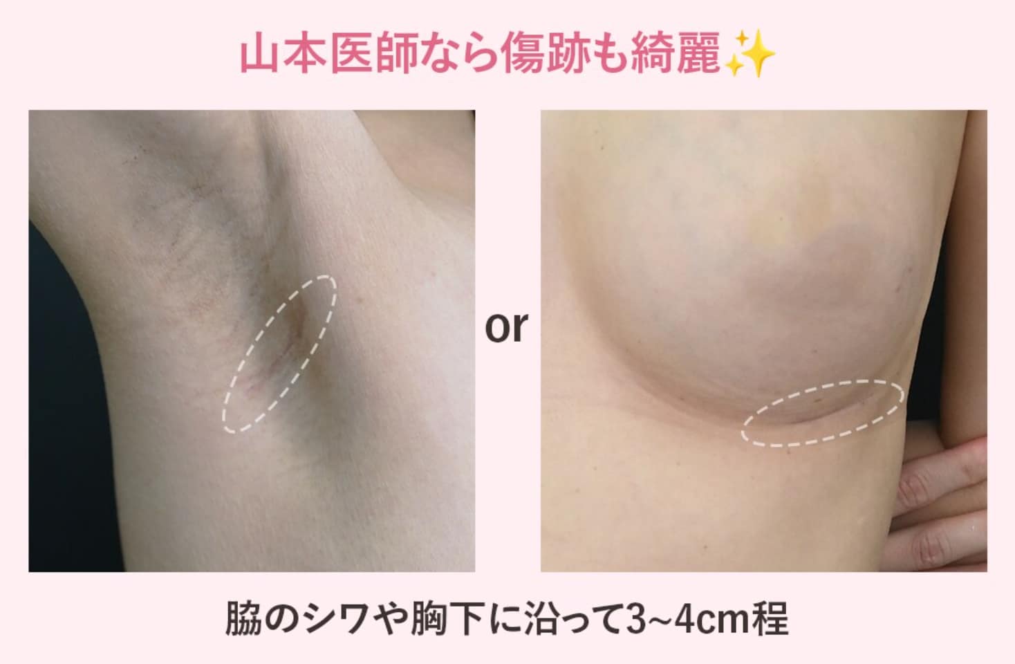 傷跡が目立たない