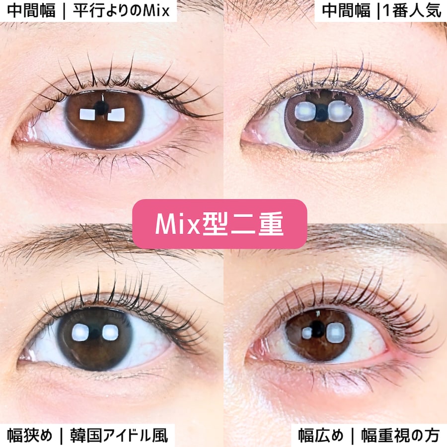 山本高士医師のMIX型二重⬇︎
