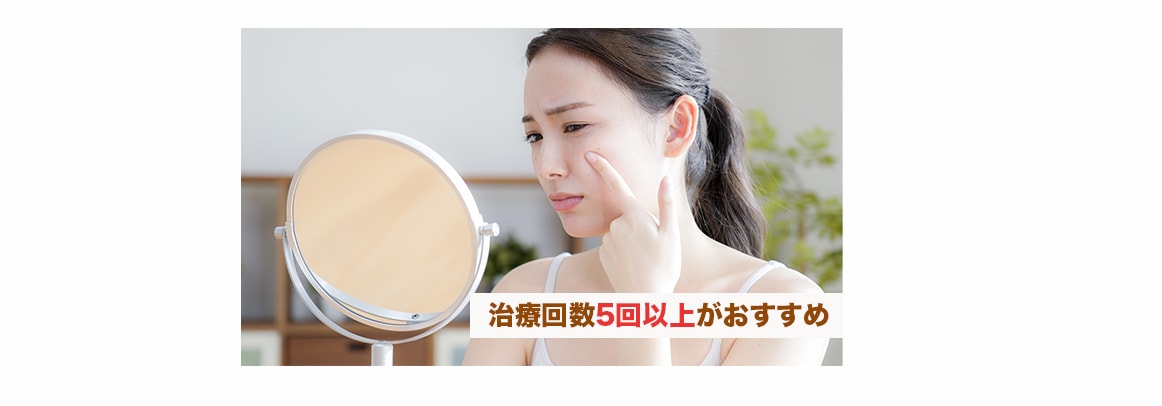 フォトダブル