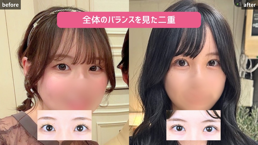 眉と目の距離・全体のバランス