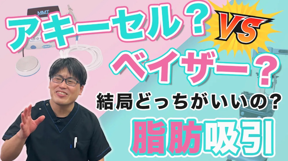 【脂肪吸引の種類・比較の解説】アキーセルとベイザーではどっちの機械がいいの?湘南美容クリニック名古屋院