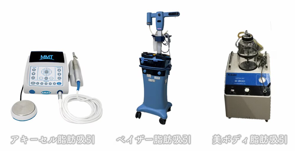 脂肪吸引の種類・比較の解説】アキーセルとベイザーではどっちの機械が