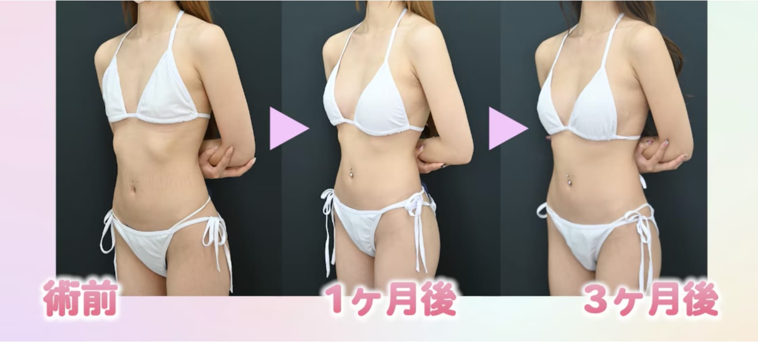 3ヶ月経ってみた感想