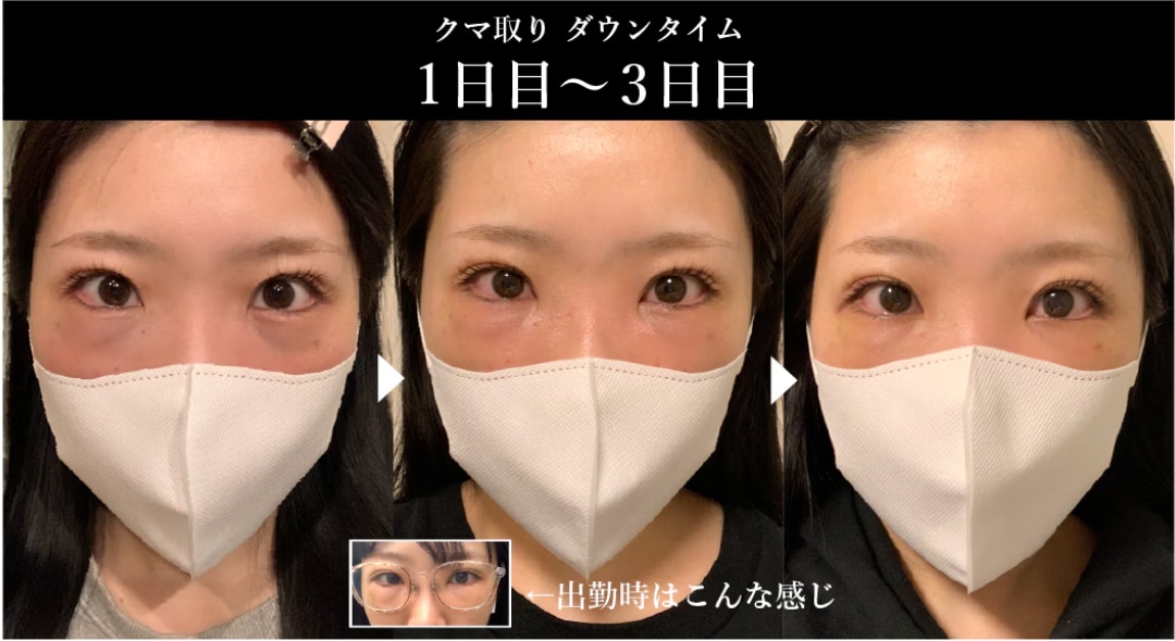 1日目から3日目