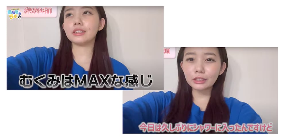 術後4日目