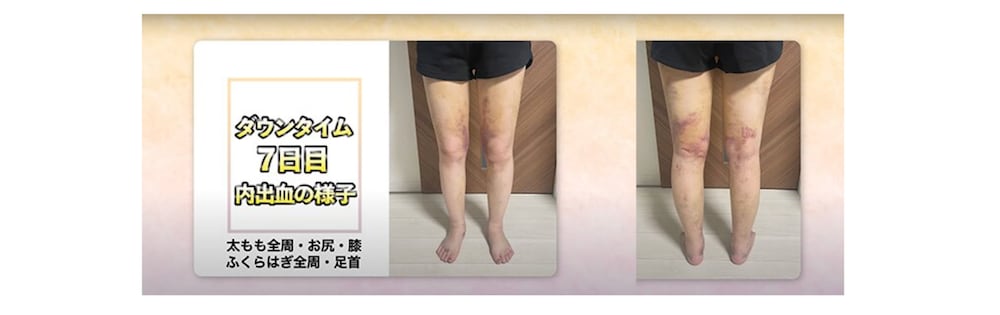 Q生活しづらいことはありましたか？