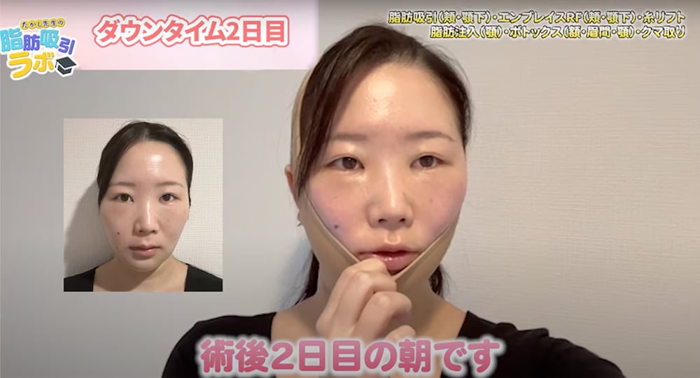 ダウンタイム2日目の朝