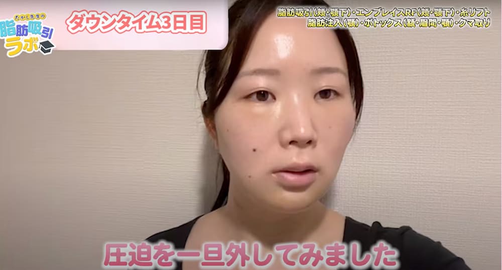 ダウンタイム3日目の夜
