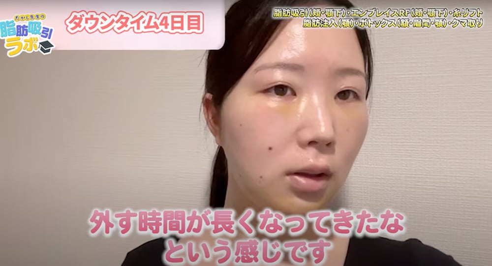 ダウンタイム4日目の夜