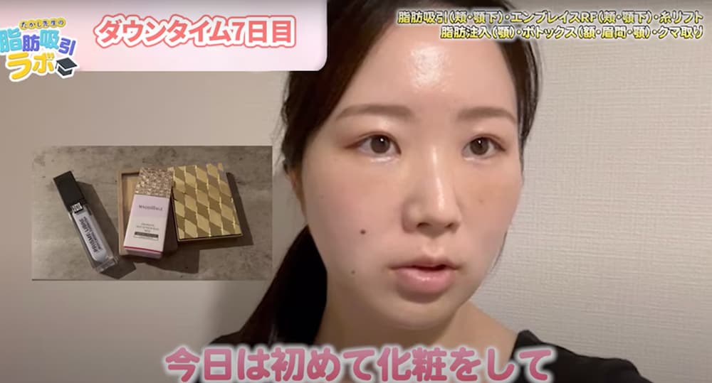ダウンタイム7日目の夜