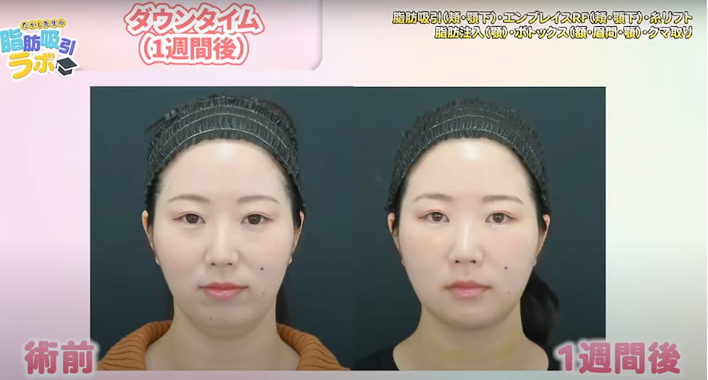 １週間の症例写真