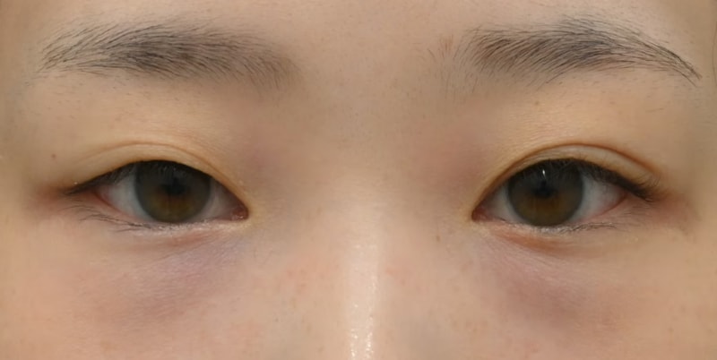 理想のかわいい目元になるフルセット