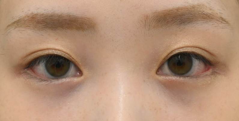 理想のかわいい目元になるフルセット