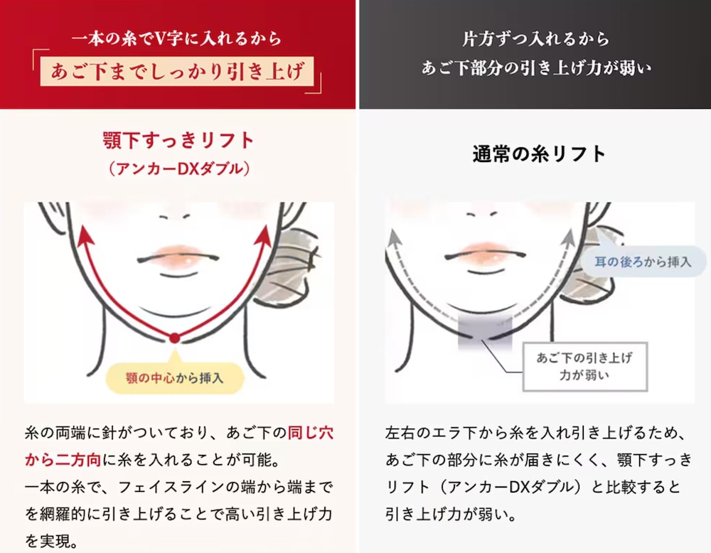 何が違う？