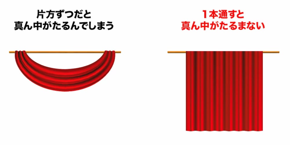顎下専用の糸リフト