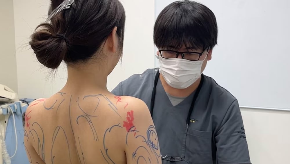 脂肪吸引西日本NO.1（SBC内2024年下半期症例数）山本医師の<br />
脂肪吸引のこだわりはなんですか？