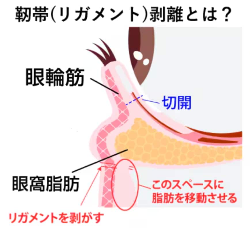 なぜ重要なのか？