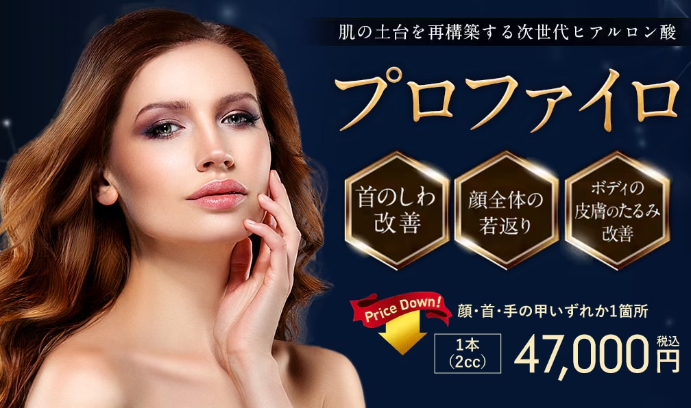 プロファイロ