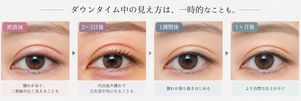 原因⑤ ダウンタイム中に仕上がりを判断してしまう