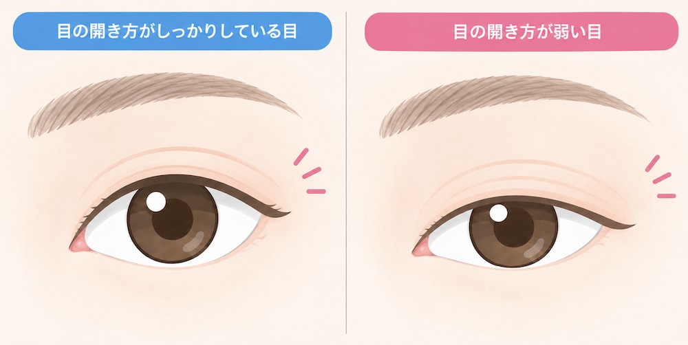 目の開き方