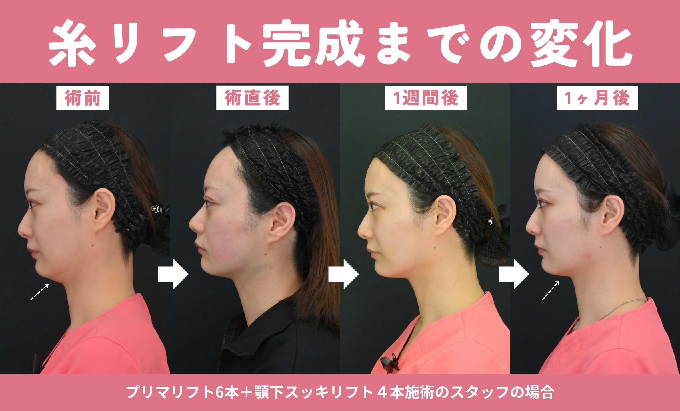 完成までの変化