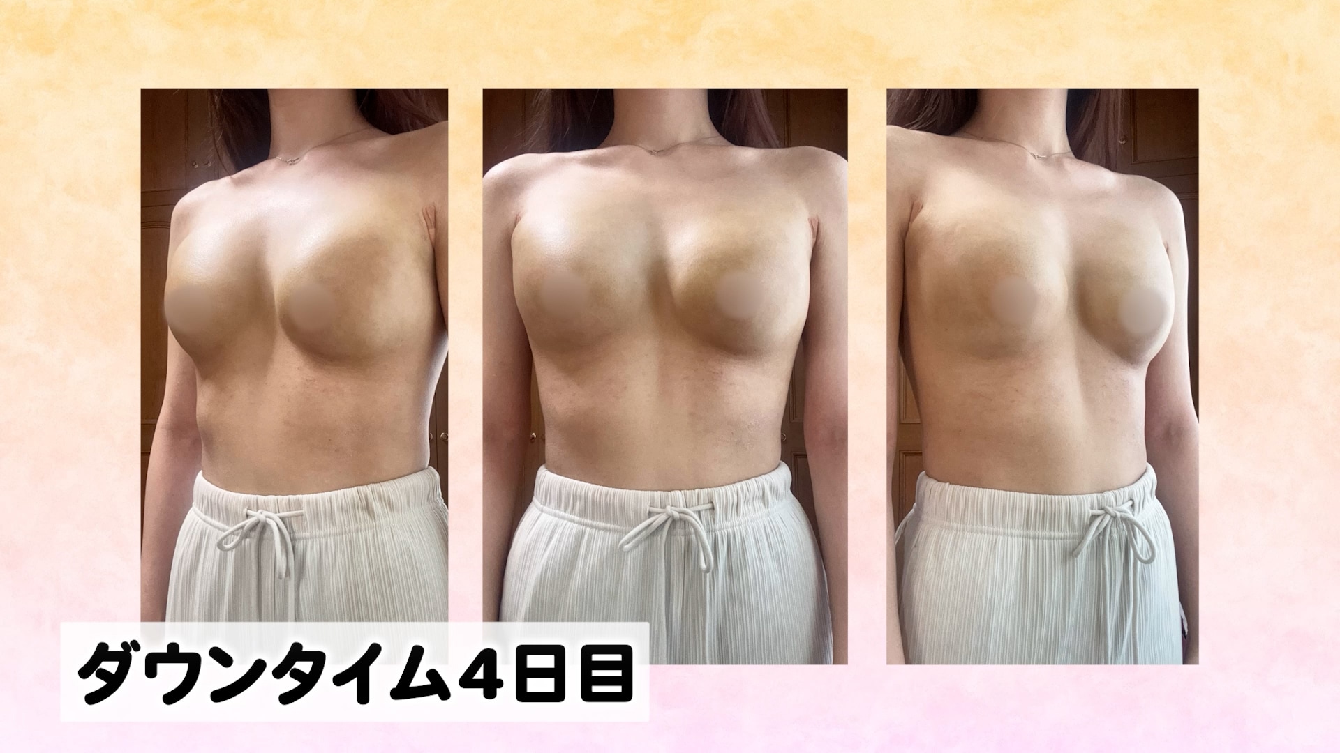 日常生活には支障なし<br />
