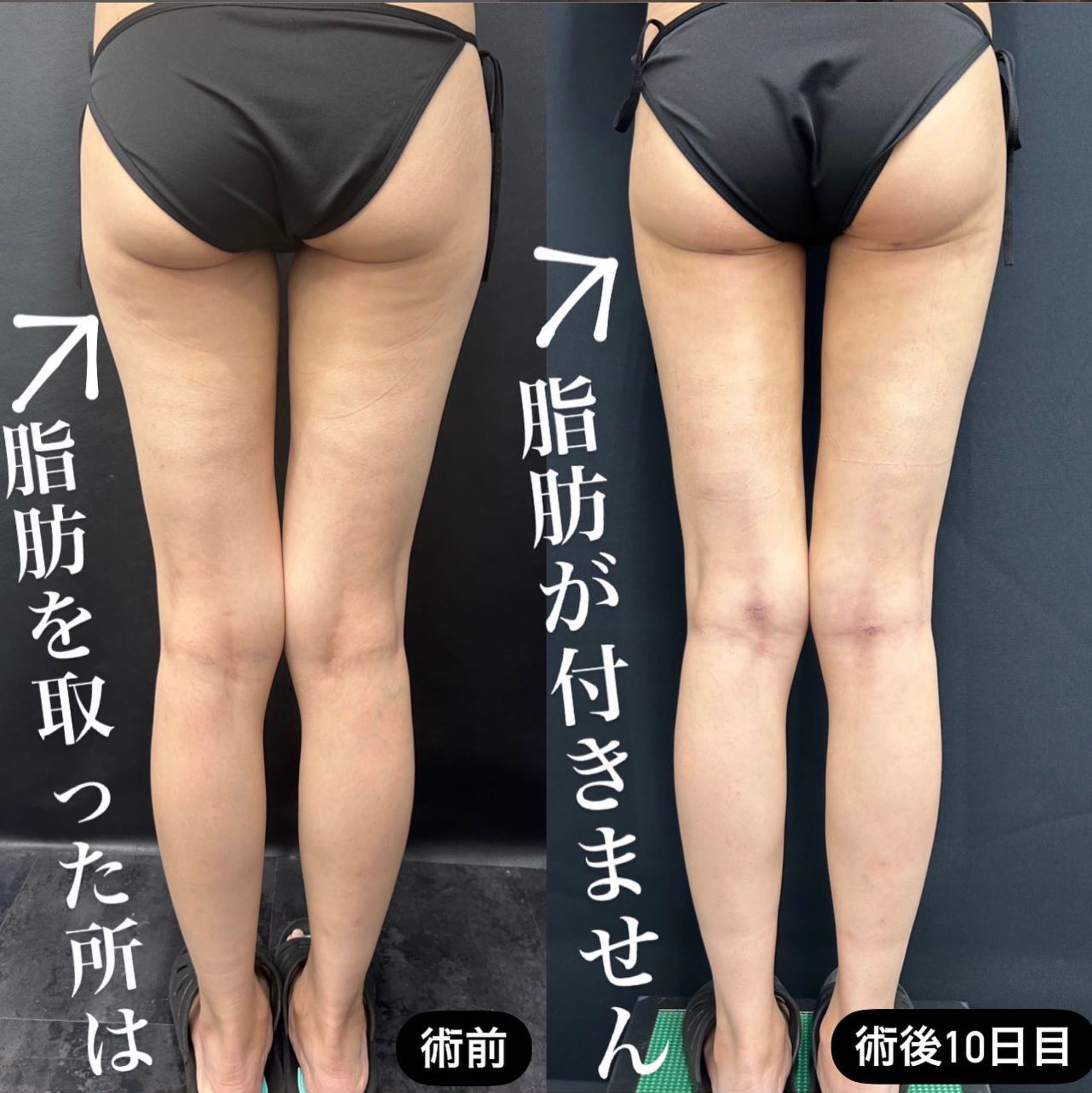 2017顔出しシミ付きパンツ 
