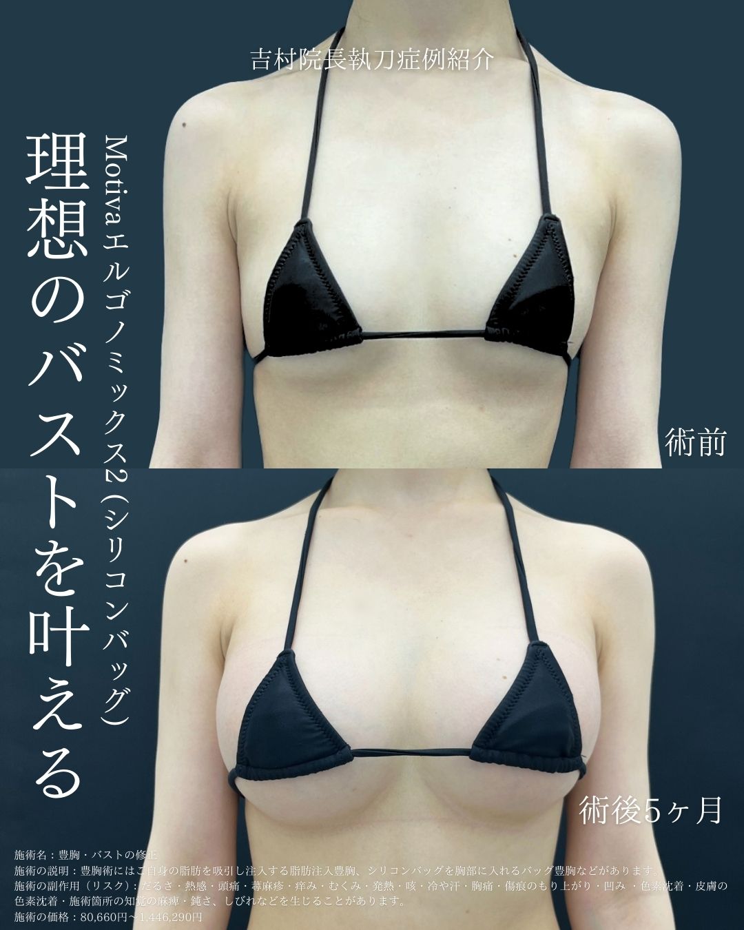沖縄(那覇)で豊胸なら！SBC那覇院の豊胸で理想のバストアップを叶えよう！